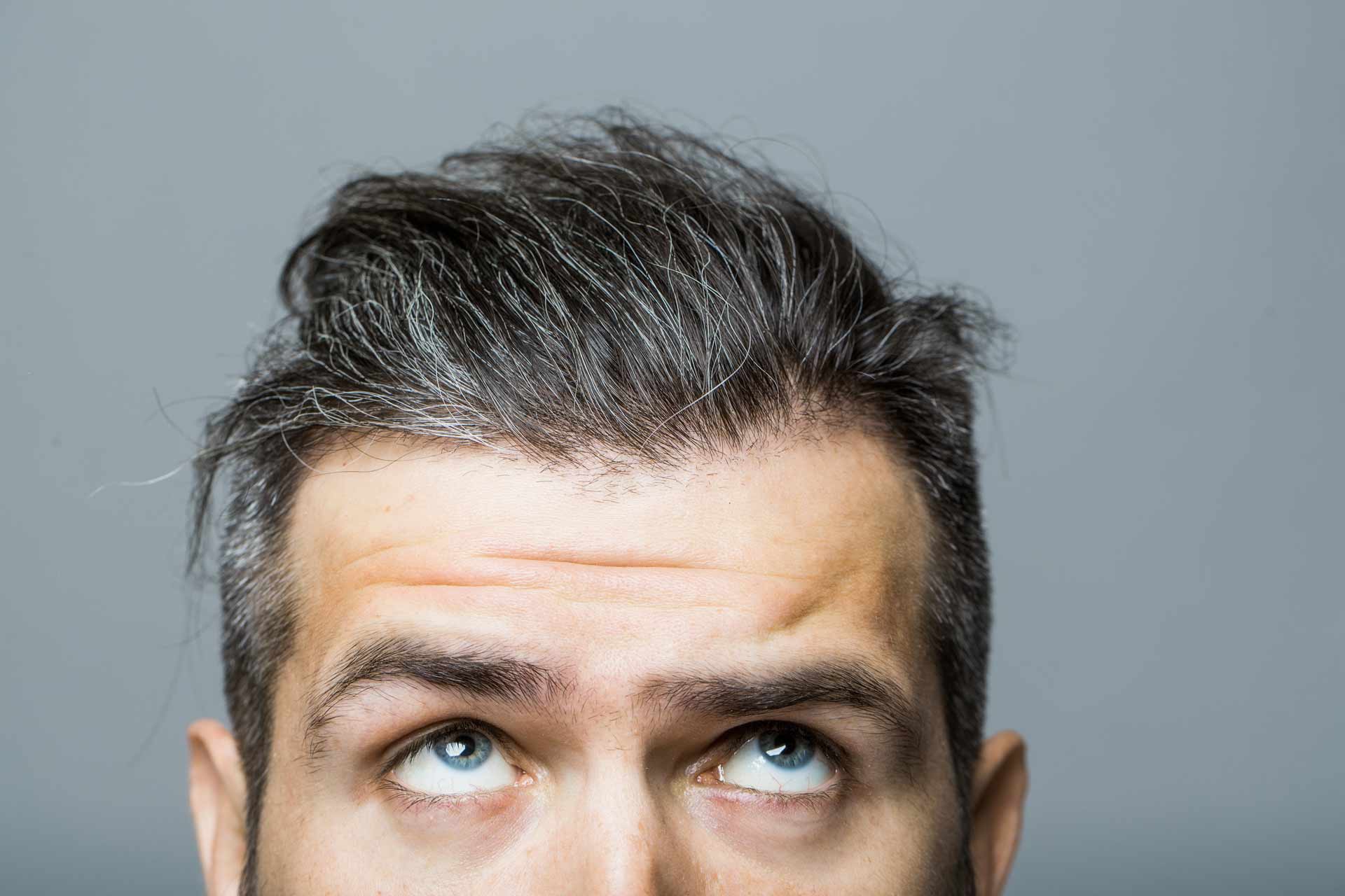 Άσπρα μαλλιά; Δε φταίει μόνο η ηλικία, φταίει και το στρες | IQ Skin Clinics